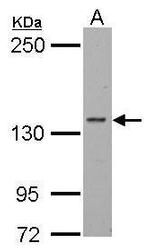 POLR2B Antibody in Western Blot (WB)