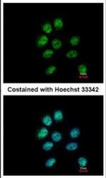 ZNF143 Polyclonal Antibody