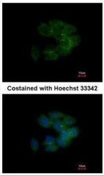 MRCK alpha Polyclonal Antibody