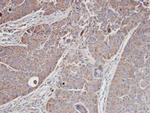 MRCK alpha Antibody in Immunohistochemistry (Paraffin) (IHC (P))