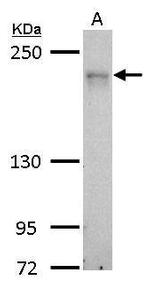 MRCK alpha Antibody in Western Blot (WB)