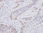 TROVE2 Polyclonal Antibody