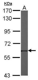 TROVE2 Antibody in Western Blot (WB)
