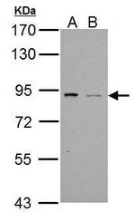 PDE4B Polyclonal Antibody