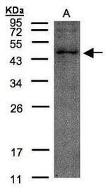 TMLHE Polyclonal Antibody