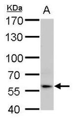 IFNAR1 Antibody in Western Blot (WB)