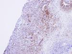 CaV1.1 Polyclonal Antibody