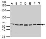 STIP1 Antibody in Western Blot (WB)