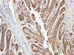 NDUFA10 Antibody in Immunohistochemistry (Paraffin) (IHC (P))