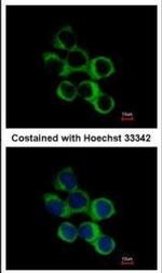 BBOX1 Polyclonal Antibody