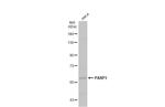 PARP3 Antibody in Western Blot (WB)