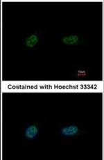 PARP3 Antibody in Immunocytochemistry (ICC/IF)