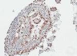 PARP3 Antibody in Immunohistochemistry (Paraffin) (IHC (P))