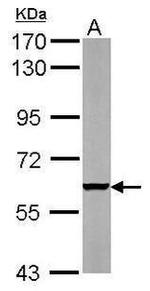PARP3 Antibody in Western Blot (WB)
