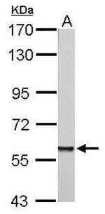 PARP3 Antibody in Western Blot (WB)