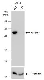 RANBP1 Antibody in Western Blot (WB)