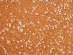 Amphiphysin Antibody in Immunohistochemistry (Paraffin) (IHC (P))