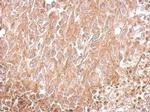 Amphiphysin Antibody in Immunohistochemistry (Paraffin) (IHC (P))