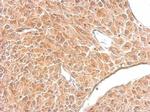 Amphiphysin Antibody in Immunohistochemistry (Paraffin) (IHC (P))