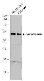 Amphiphysin Antibody in Western Blot (WB)