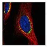 COPD Polyclonal Antibody