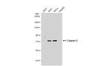 Calpain 5 Antibody in Western Blot (WB)
