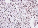 ORC2 Polyclonal Antibody