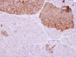 IL22RA2 Polyclonal Antibody
