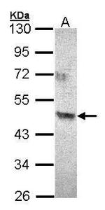 ACAD8 Polyclonal Antibody