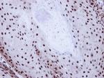 GABPB1 Antibody in Immunohistochemistry (Paraffin) (IHC (P))