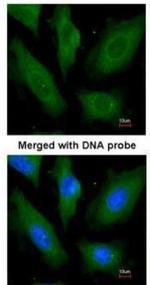 SCYL3 Polyclonal Antibody