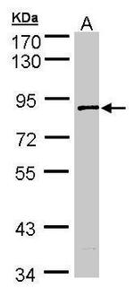 SCYL3 Antibody in Western Blot (WB)