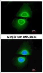 CYP4A11 Polyclonal Antibody