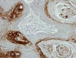 Kallikrein 7 Antibody in Immunohistochemistry (Paraffin) (IHC (P))