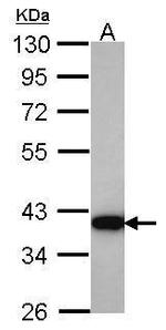 AKR1C4 Antibody in Western Blot (WB)