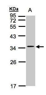 CACNG5 Polyclonal Antibody