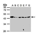MPI Antibody in Western Blot (WB)