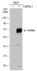 FGFR5 Antibody in Western Blot (WB)