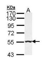 GLYCTK Antibody in Western Blot (WB)