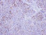 HSD17B4 Antibody in Immunohistochemistry (Paraffin) (IHC (P))
