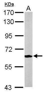 MPP2 Polyclonal Antibody