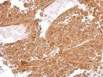 MRPS5 Antibody in Immunohistochemistry (Paraffin) (IHC (P))