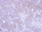 ST3GAL2 Polyclonal Antibody