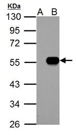 IP6K1 Antibody in Western Blot (WB)