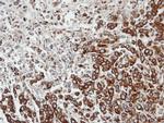 FPGT Polyclonal Antibody
