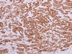 PON2 Polyclonal Antibody