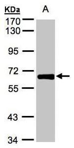 ZNF169 Polyclonal Antibody