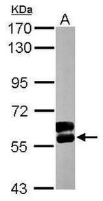 PPP3CB Antibody in Western Blot (WB)