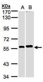 PPP3CB Antibody in Western Blot (WB)