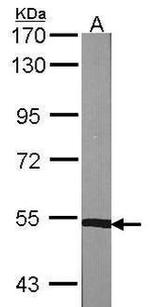 PPP3CB Antibody in Western Blot (WB)